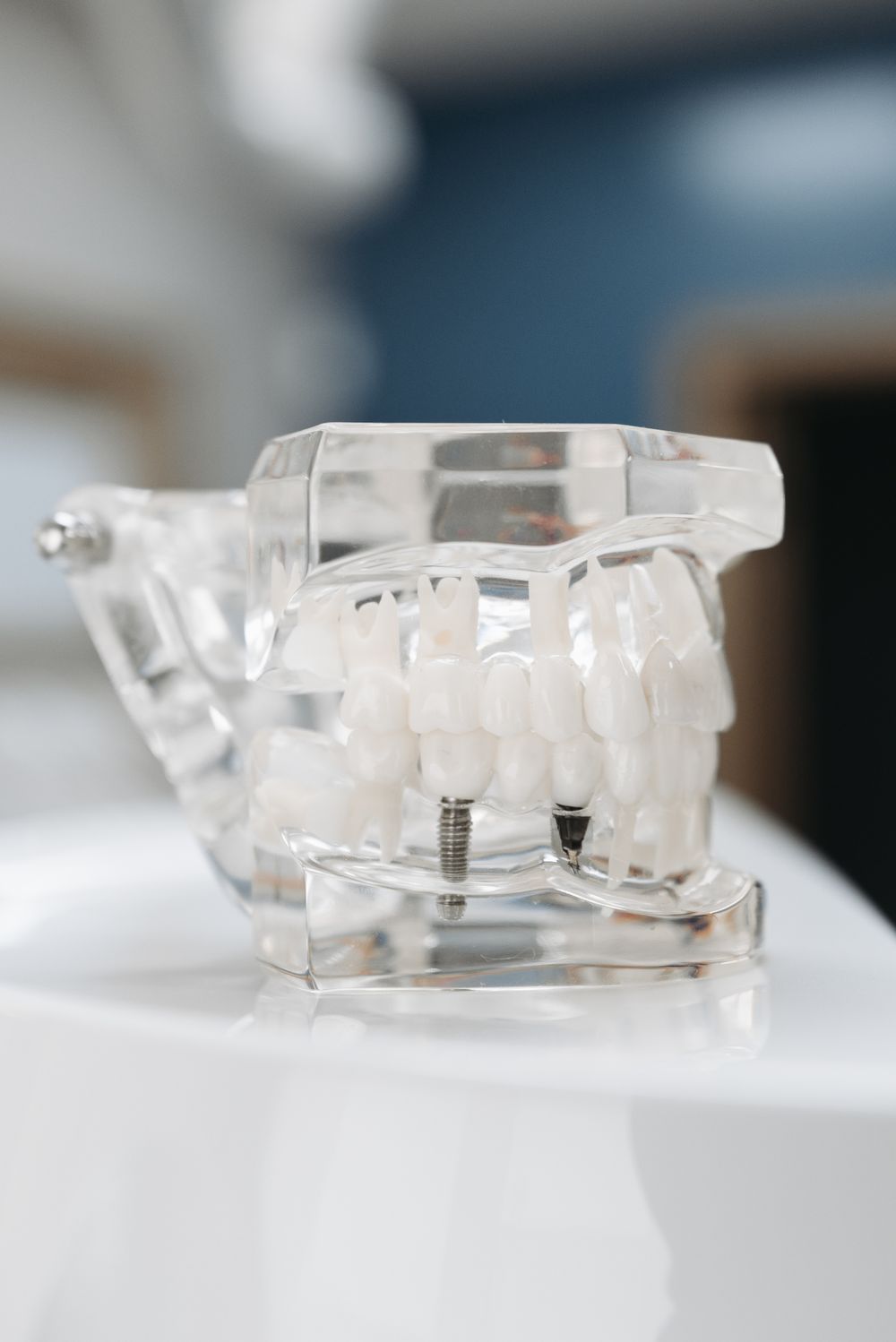 Modelo transparente de arcada com implantes dentários